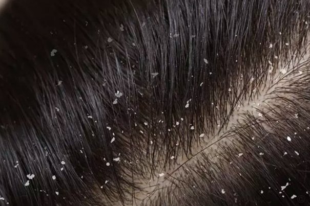 得物佳物分期可以提现吗？